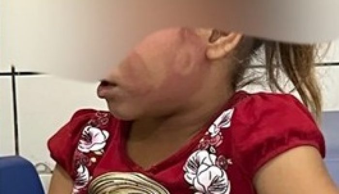 Criança agredida - Foto: Reprodução