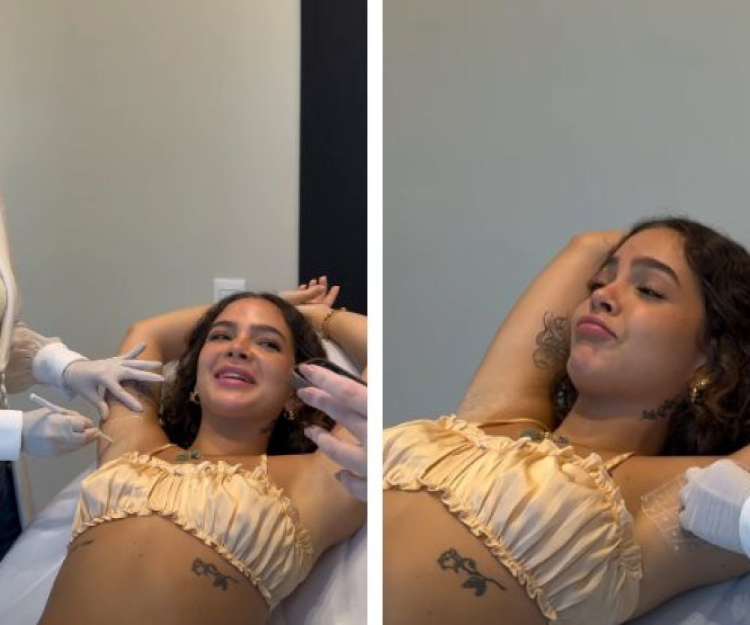 Por que Mel Maia colocou botox nas axilas? A explicação pode te interessar